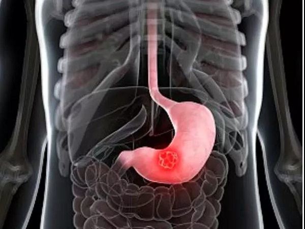 008PG国际(中国集团)-官方网站